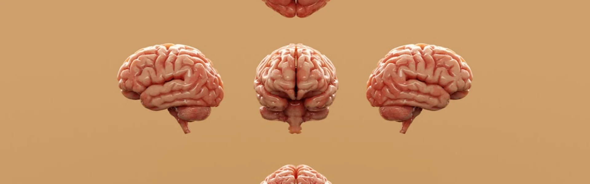 Hotchkiss Brain Institute